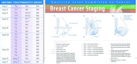 Breast Cancer Tnm Staging Chart Keski