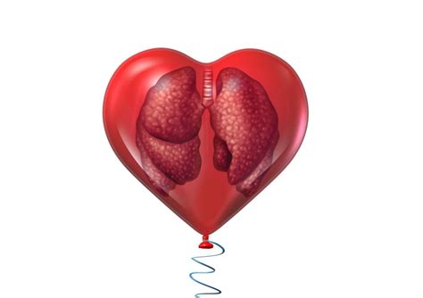 Cardiorespiratory fitness lowers cancer risk