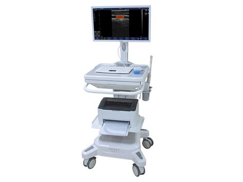 TrolleyUS SonoStar Manufacturer Of Palm Ultrasound Handle Ultrasound