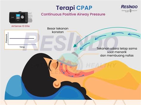 Cara Kerja Mesin CPAP Resindo Medika