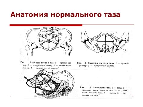 Узкий и клинически узкий таз в современном акушерстве