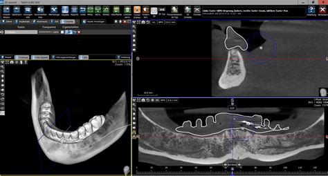 DVT Fachkunde - Alles, was Sie wissen müssen! - Dentalvolumen.de - DVT ...