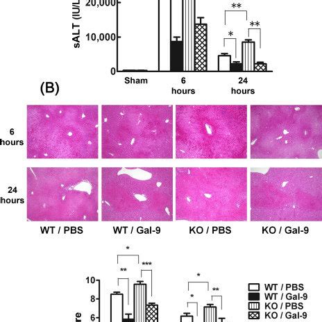 Liver Damage Induced By Iri In Wild Mice Or Gal Deficient Mice With