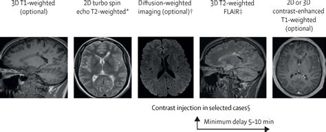 Sequence Specific Mr Imaging Findings That Are Useful In Dating Ischemic Stroke Telegraph