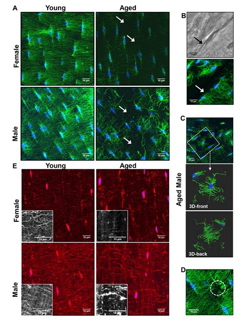 Degeneration Of The Osteocyte Network In The C Bl Mouse Model Of