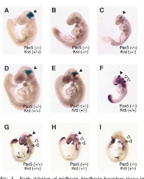 cerebellum development | Semantic Scholar