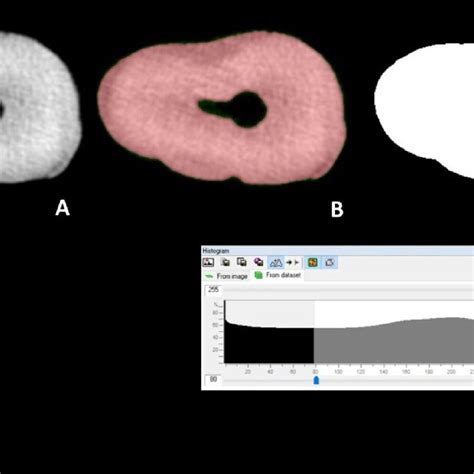 nt mesiobuccal root  instrumentation  raw image  microct