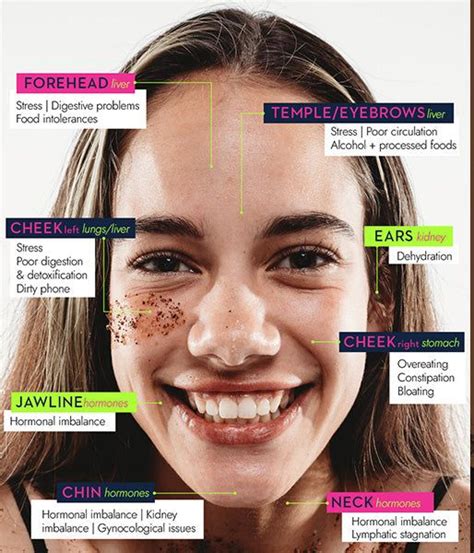 Face Mapping And Acne How Do I Treat Pimples Face Mapping Acne