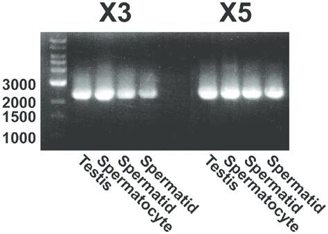 PCR Amplification Of CDNA Encoding PDE10A Variants X3 And X5 In Bovine