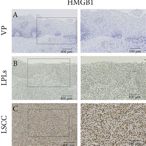 Immunohistochemical Staining And Semiquantitative Evaluation Of Hmgb1 Download Scientific