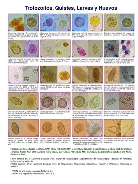 430 best Parasites images on Pinterest | Medical, Medical science and ...