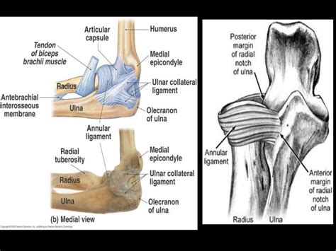 Upper limb fractures (part2)