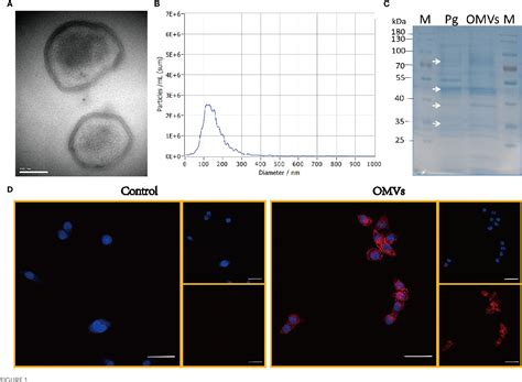 Figure 1 From Outer Membrane Vesicles Of Porphyromonas Gingivalis