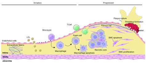 Atherosclerosis initiation and progression. The early development of ...