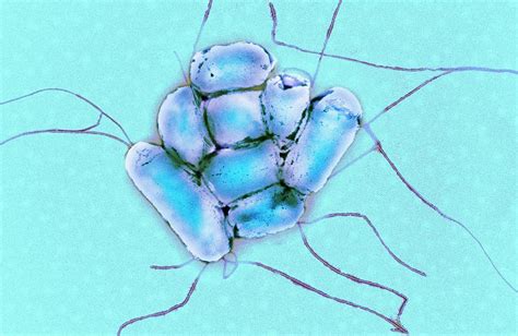 E Coli Bacteria 18 Photograph By Centre For Infectionspublic Health Englandscience Photo