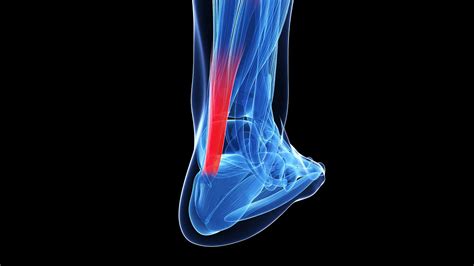 Revitalize Your Movement: Ligament & Tendon Injury Solutions