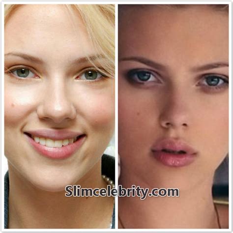 Scarlett Johansson Plastic Surgery Before And After Photos Nose Job