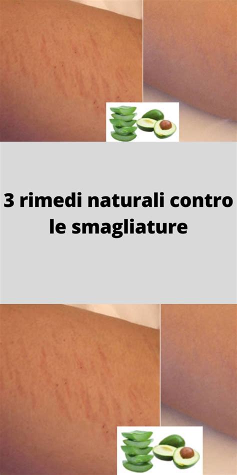 Rimedi Naturali Per Allontanare Le Formiche Per Sempre Artofit