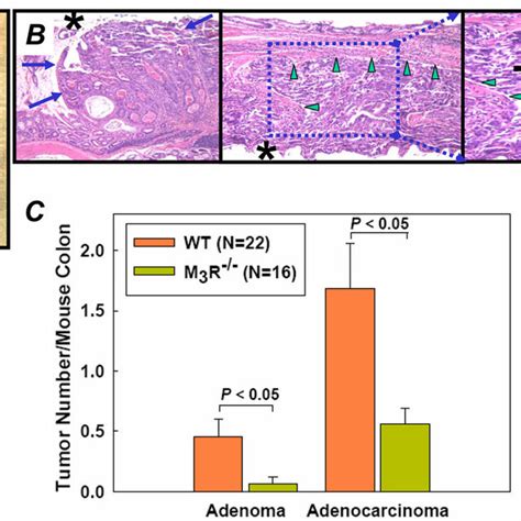 Macroscopic Colon Tumors In PBS And AOM Treated WT And M 3 R