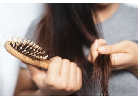 Principales Causas De La Caída Del Cabello En Mujeres Nigare