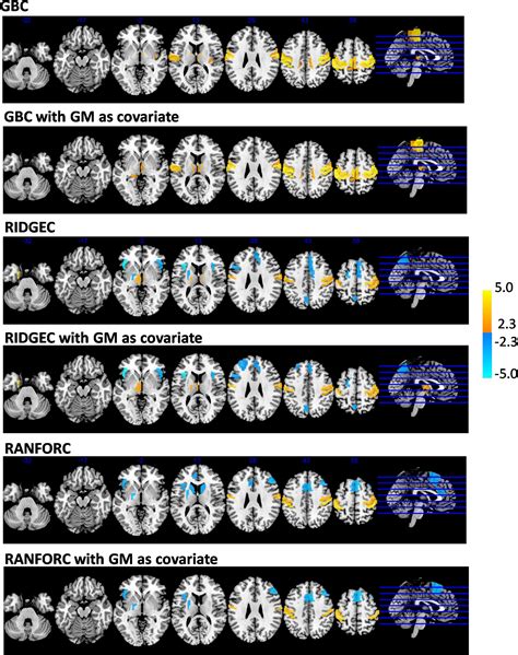 Frontiers Multivariate Brain Functional Connectivity Through