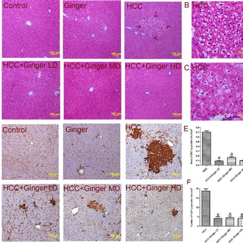 Ginger Inhibits DEN 2 AAF Induced Induction Of AHF And Of GST P