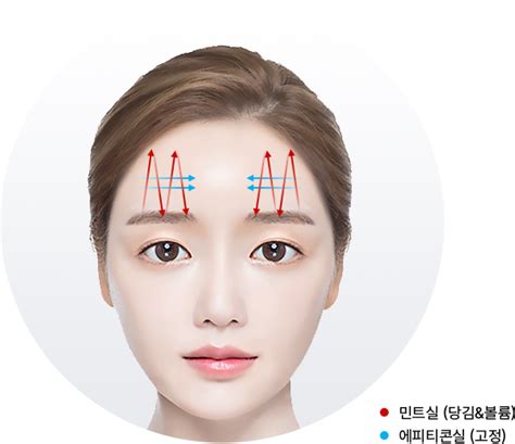 이마거상리프팅 유앤미클리닉