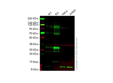 Anti Beta 2 Microglobulin Antibody B2m 01 Pe⚰️ Revolucione Seu Dia