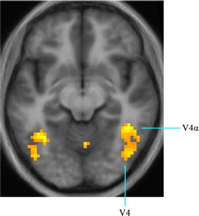 Activity produced in the fusiform gyrus (V4 complex) in the contrast ...