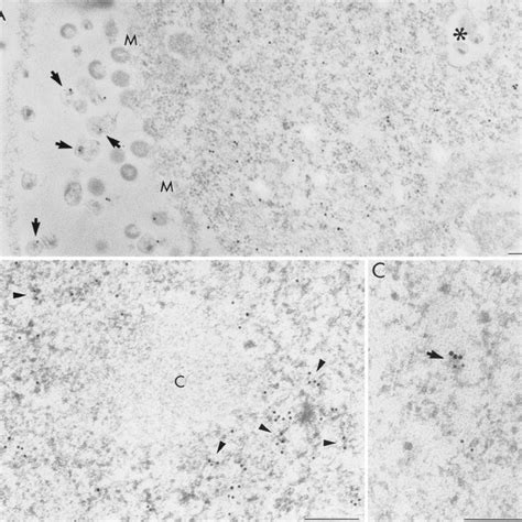 Immunoelectron Microscopic Localization Of In Situ Hybridization Signal