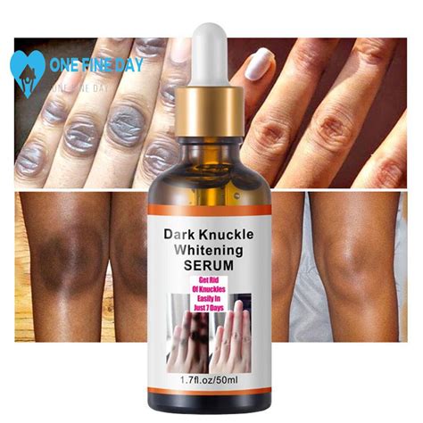 Get Rid Of Dark Knuckles In Days Serum Whitening Removing Dark