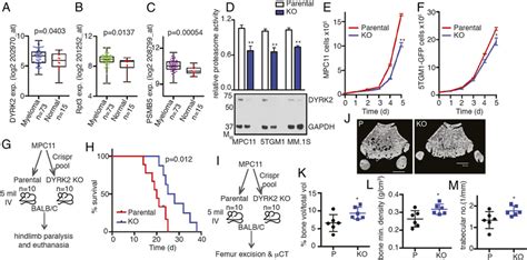 Dyrk Promotes Myeloma Progression And Myeloma Mediated Bone