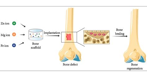 Functional Macromolecular Adhesives For Bone Fracture