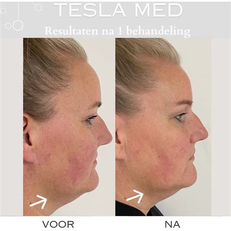 Tesla Med Annie Verhoeven Schoonheidssalon