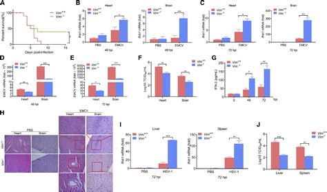 Vimentin Inhibits Type I Interferon Production By Disrupting The Tbk1