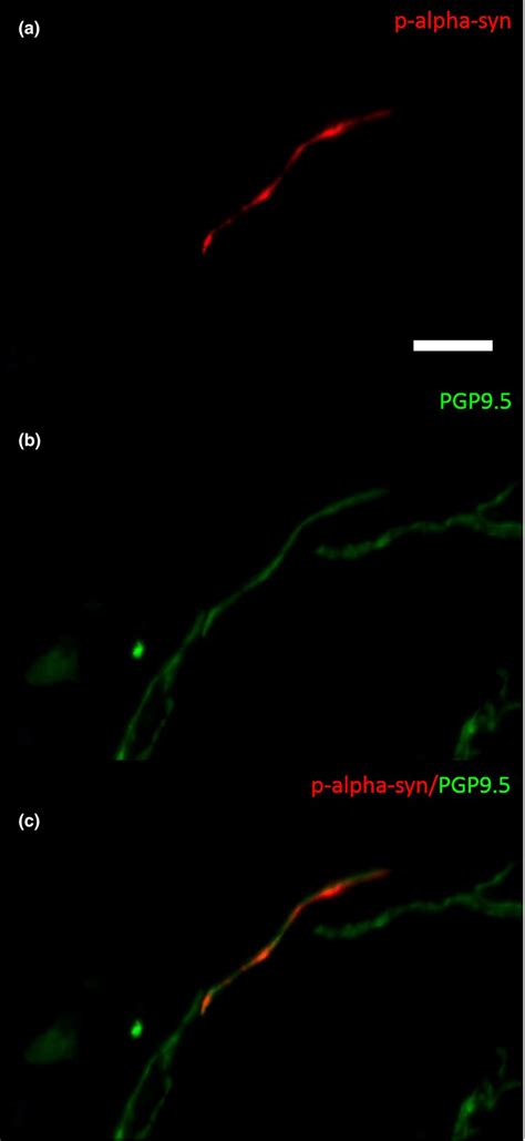 Photomicrograph Of A Doubleimmunofluorescence Staining With