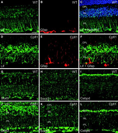 Müller Glia Cells In The Cpfl1 Retina Induce Lif Confocal Laser