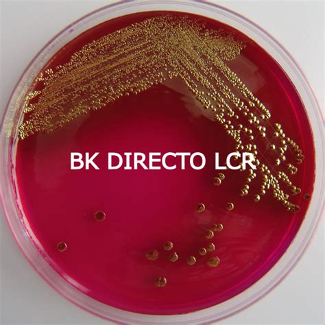 BK DIRECTO LCR OVLAB O V Laboratorios