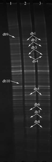 Dgge Gel Pro Fi Les Of The Dna Samples With Different Tm Extraction Download Scientific Diagram