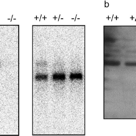 A Detection Of Gad65 Transcripts By Northern Blot Analysis Brain Download Scientific Diagram