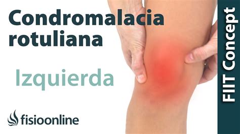 Condropatía de rótula o condromalacia rotuliana diagnóstico