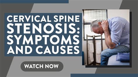 Cervical spine stenosis: Symptoms and causes - YouTube