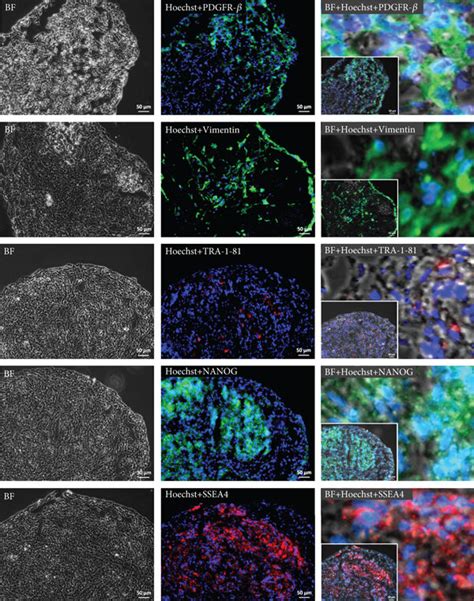 Expression Of Kidney Markers Six Pax Nephrin And Podocin