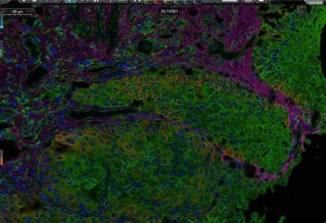 Tyramide Signal Amplification TSA ABP Biosciences