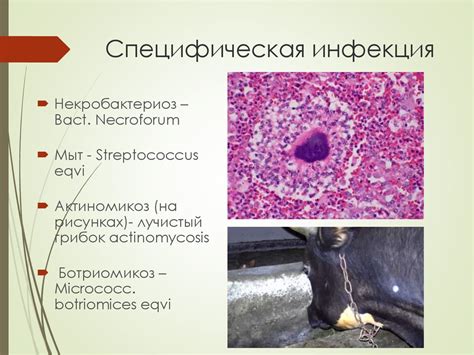Клинические формы хирургической инфекции. Острая гнойная инфекция ...