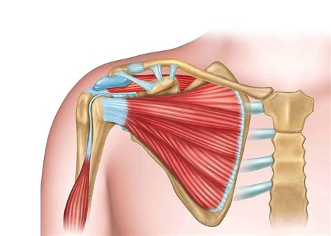 Réparation de la coiffe des rotateurs chirurgie de l épaule à Nice