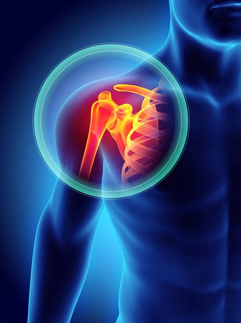 Are You Suffering From Shoulder Pain In The Edgewater Area?
