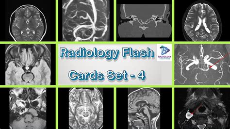 Radiology Flash Cards Set Dr B Surendra Kumar Neuroradiology Youtube