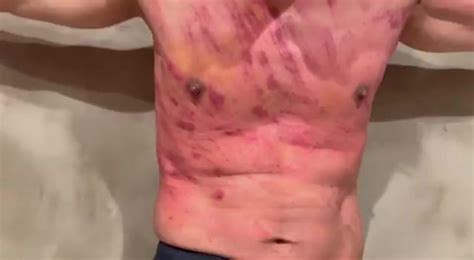 Master And Slave Privat Hot Top Spanking Video 7 ThisVid