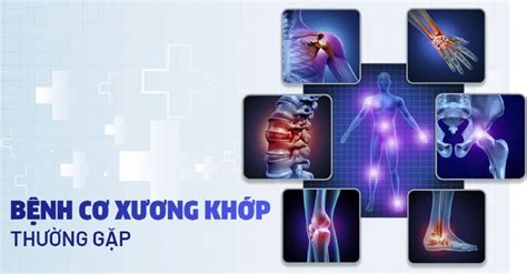 8 căn bệnh cơ xương khớp thường gặp và cách phòng tránh VIETMY CLINIC